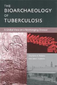 Bioarchaeology of Tuberculosis