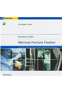 Minimax Fracture Fixation