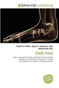 Club Foot