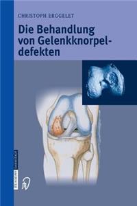 Die Behandlung von Gelenkknorpeldefekten