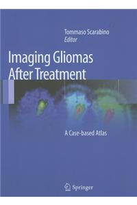 Imaging Gliomas After Treatment