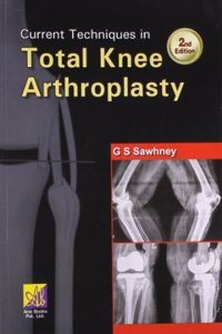 Current Techniques in Total Knee Arthroscopy, 2/e