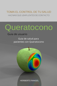 Queratocono guia de usuario