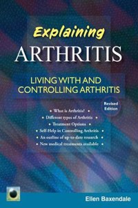 An Emerald Guide to Explaining Arthritis