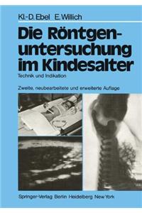 Die Rontgenuntersuchung im Kindesalter