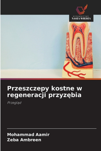 Przeszczepy kostne w regeneracji przyzębia