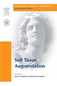 Soft Tissue Augmentation