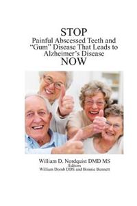 Stop Painful Abscessed Teeth and Gum Disease that Leads to Alzheimer's Now.