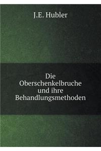 Die Oberschenkelbruche und ihre Behandlungsmethoden