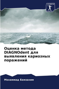 Оценка метода DIAGNOdent для выявления кариозных п&#