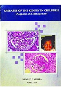 DISEASES OF THE KIDNEY IN CHILDREN DIAGNOSIS AND MANAGEMENT
