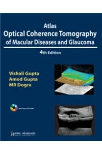 Atlas Optical Coherence Tomography of Macular Diseases and Glaucoma