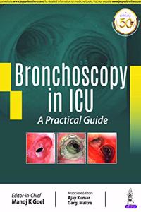 Bronchoscopy in ICU: A Practical Guide