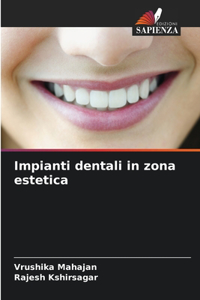 Impianti dentali in zona estetica