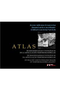 Atlas