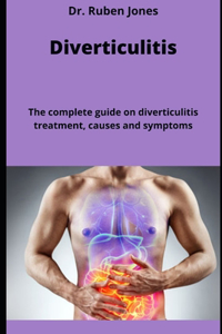 Diverticulitis