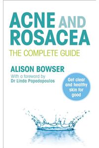 Acne and Rosacea