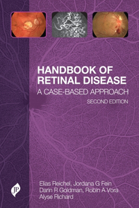 Handbook of Retinal Disease