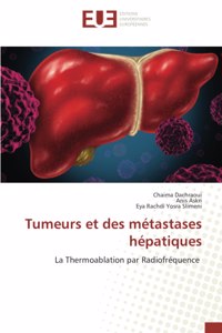 Tumeurs et des métastases hépatiques