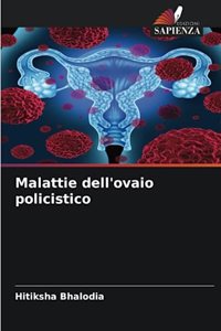 Malattie dell'ovaio policistico