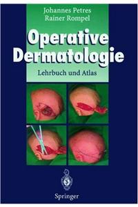 Operative Dermatologie: Lehrbuch Und Atlas