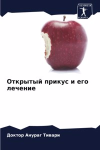 Открытый прикус и его лечение