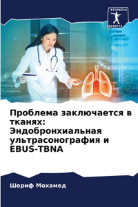 Проблема заключается в тканях