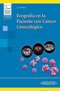 Ecografia en la Paciente con Cancer Ginecologico