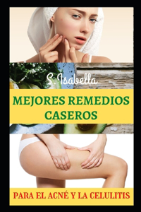 Mejores Remedios Caseros