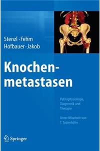 Knochenmetastasen