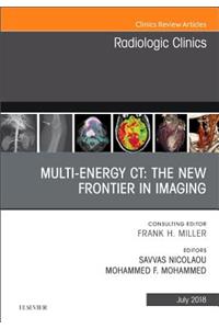 Multi-Energy Ct: The New Frontier in Imaging, an Issue of Radiologic Clinics of North America