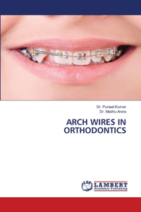 Arch Wires in Orthodontics