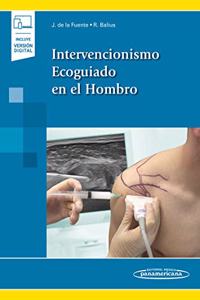 Intervencionismo Ecoguiado en el Hombro