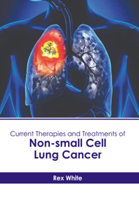 Current Therapies and Treatments of Non-Small Cell Lung Cancer