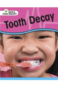 Tooth Decay