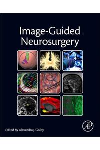 Image-Guided Neurosurgery