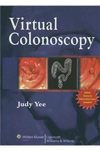 Virtual Colonoscopy