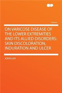 On Varicose Disease of the Lower Extremities and Its Allied Disorders