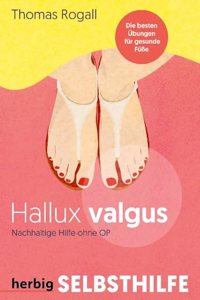 Hallux Valgus - Nachhaltige Hilfe ohne OP