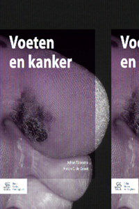 Voeten En Kanker