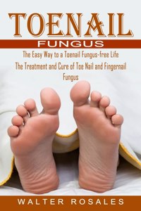 Toenail Fungus