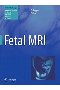 Fetal MRI