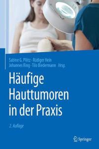 Häufige Hauttumoren in Der PRAXIS