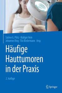 Häufige Hauttumoren in Der Praxis