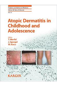 Atopic Dermatitis in Childhood and Adolescence