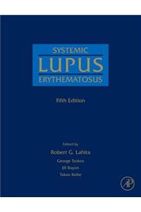 Systemic Lupus Erythematosus