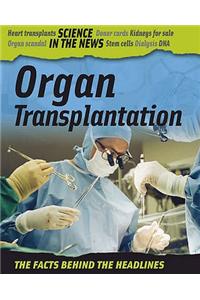 Organ Transplantation