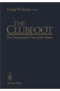 Clubfoot