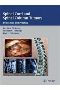 Spinal Cord and Spinal Column Tumors