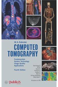 Computed Tomography